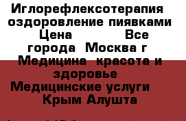 Иглорефлексотерапия, оздоровление пиявками › Цена ­ 3 000 - Все города, Москва г. Медицина, красота и здоровье » Медицинские услуги   . Крым,Алушта